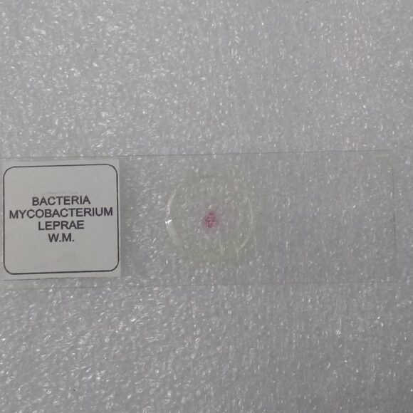 IMG_20250308_162511 580x580